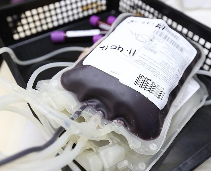 Does smoking cannabis prevent blood donation?